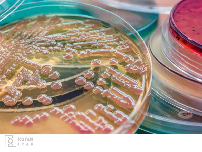 معیارهای انتخای محیط کشت مناسب