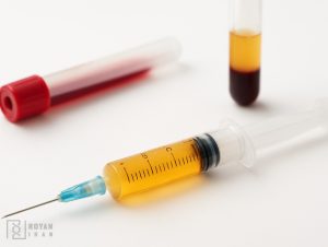 ماندگاری بایوفیلر یا پلاسماژل